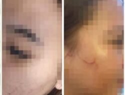 Dua Perempuan Jadi Korban Pengeroyokan di Tempat Hiburan Malam di Daya, Polisi Imbau Hadirkan Saksi
